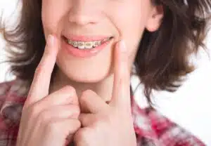 Benefits of Wearing Braces: Essential Reasons You Didn’t Expect
