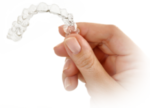 Invisalign Treatment Length: What You Need to Know Prior