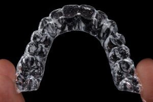 Top Invisalign Tips for Staying on Track and Achieving Ideal Results