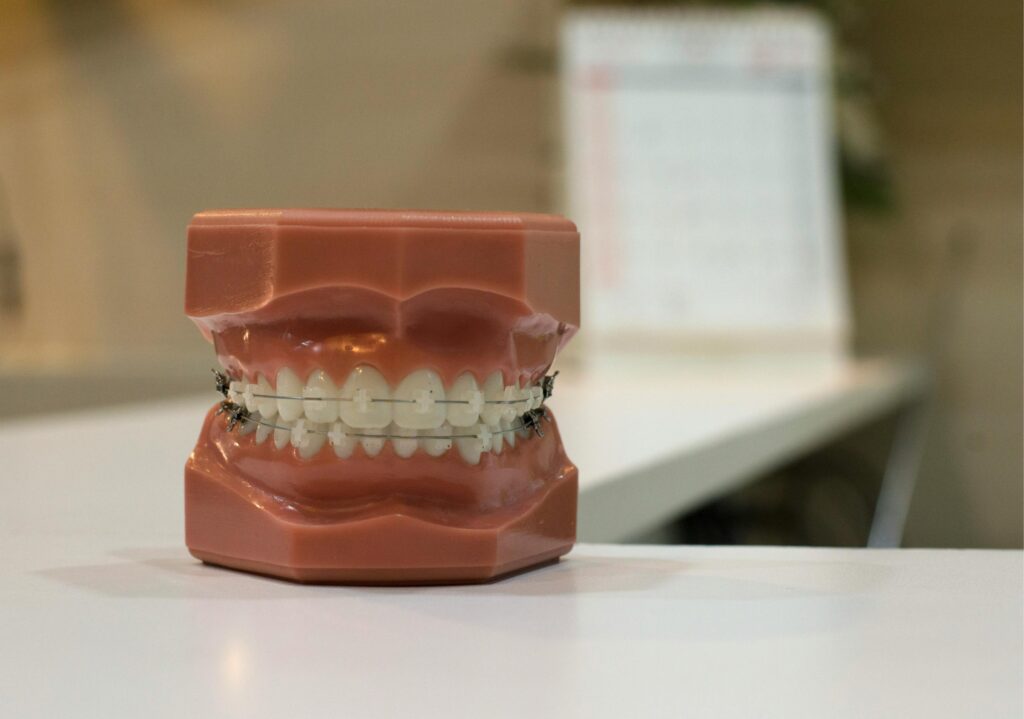 Retainers After Braces: Key Differences for Kids, Teens, and Adults