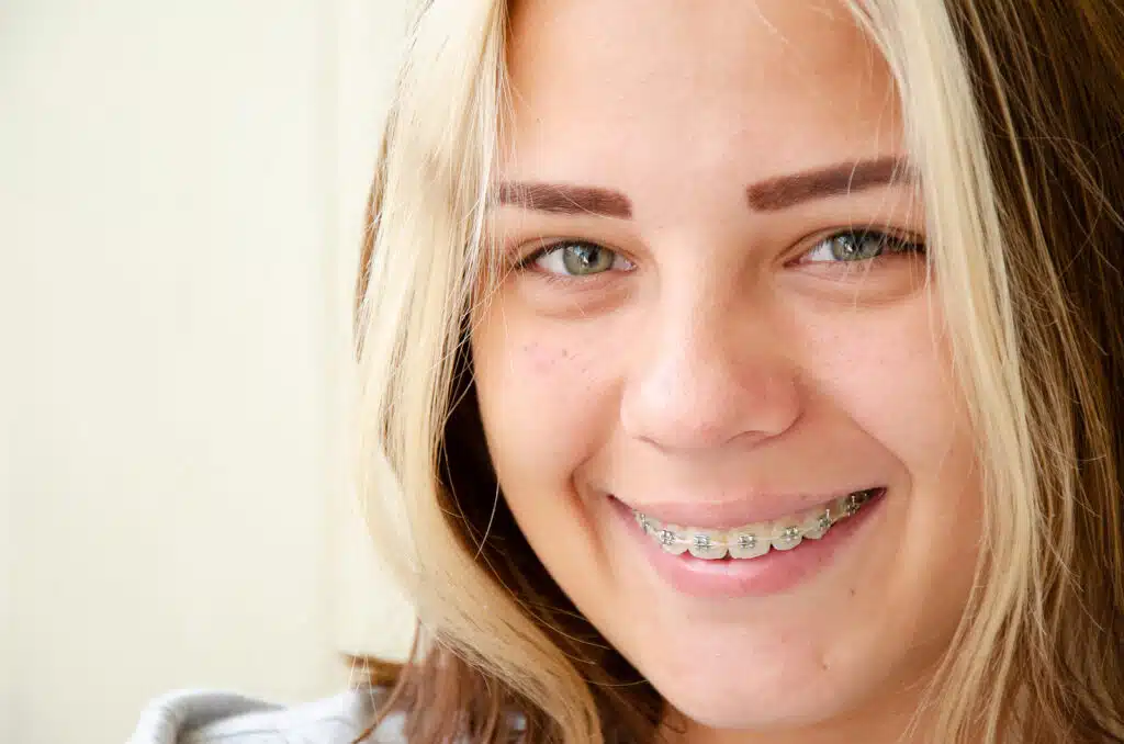 Orthodontics for Teens Consultation Columbia SC