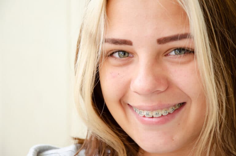 Orthodontics for Teens Consultation Columbia SC