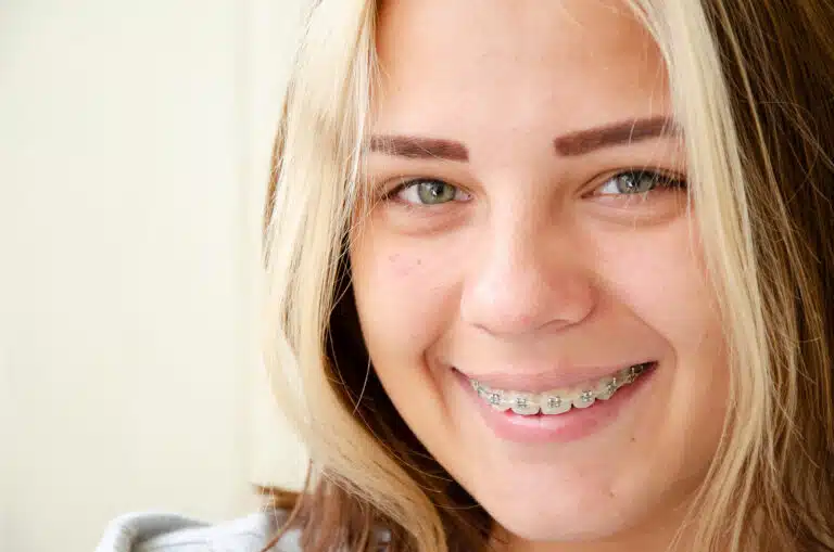 Orthodontics for Teens Consultation Columbia SC