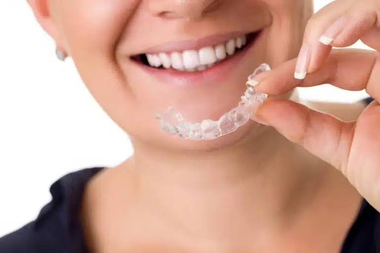 Smile Invisible Aligners for Adults