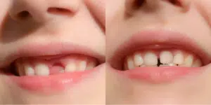 Orthodontist with a young patient during an exam focused on children&rsquo;s bite development