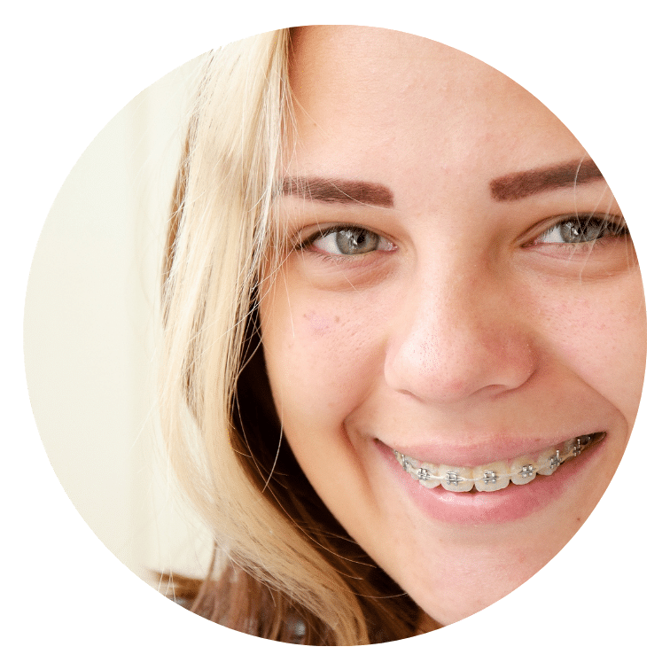 Teen smiling with braces near Winnsboro SC