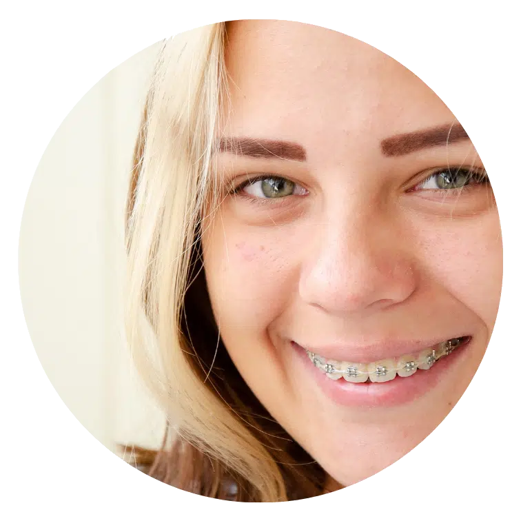 Teen smiling with braces near Winnsboro SC